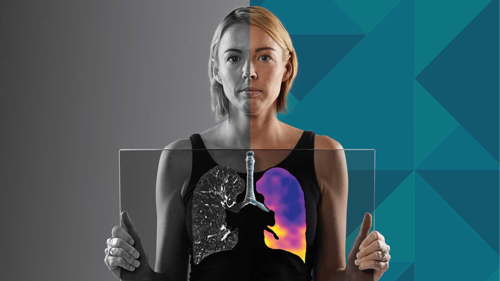 A woman holds a clear panel over her chest: one lung is shown as a conventional CT image, the other as a colour CT:VQ perfusion map